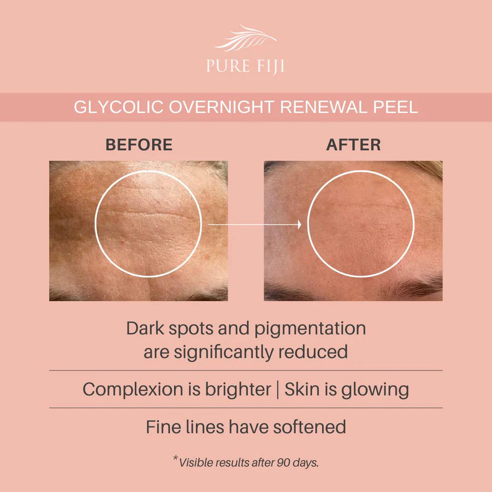 Pure Fiji - Glycolic Overnight Renewal Peel with Mandelic + Niacinamide 30ml